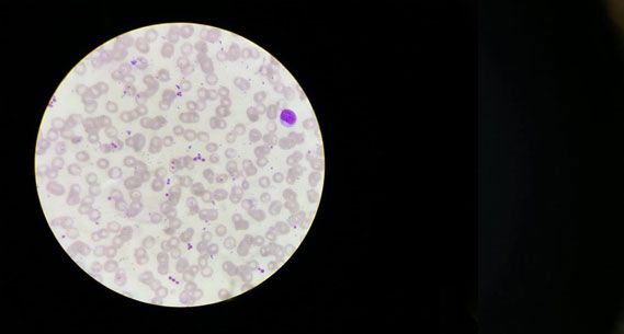 Microscope image: platelets evenly spread without EDTA
