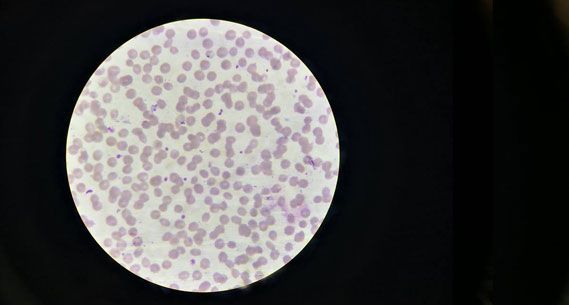 Microscope image: normal platelets without EDTA